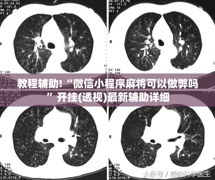教程辅助!“微信小程序麻将可以做弊吗”开挂(透视)最新辅助详细