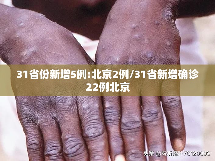 31省份新增5例:北京2例/31省新增确诊22例北京 31省份新增5例:北京2例/31省新增确诊22例北京