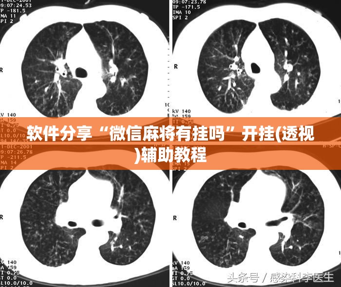 软件分享“微信麻将有挂吗	”开挂(透视)辅助教程