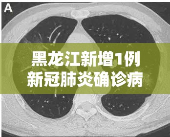 黑龙江新增1例新冠肺炎确诊病例/黑龙江新增1例确诊活动轨迹 黑龙江新增1例新冠肺炎确诊病例/黑龙江新增1例确诊活动轨迹