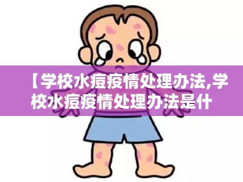 【学校水痘疫情处理办法,学校水痘疫情处理办法是什么】 【学校水痘疫情处理办法,学校水痘疫情处理办法是什么】