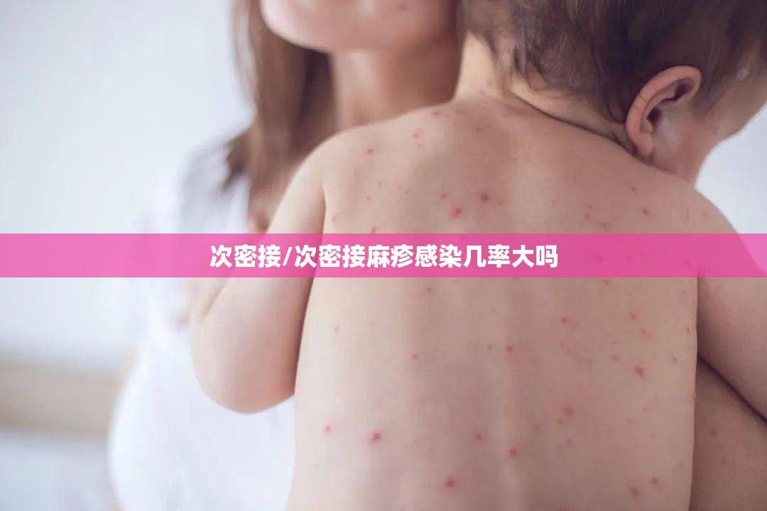 次密接/次密接麻疹感染几率大吗