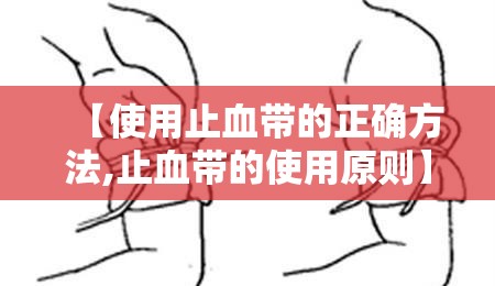 【使用止血带的正确方法,止血带的使用原则】