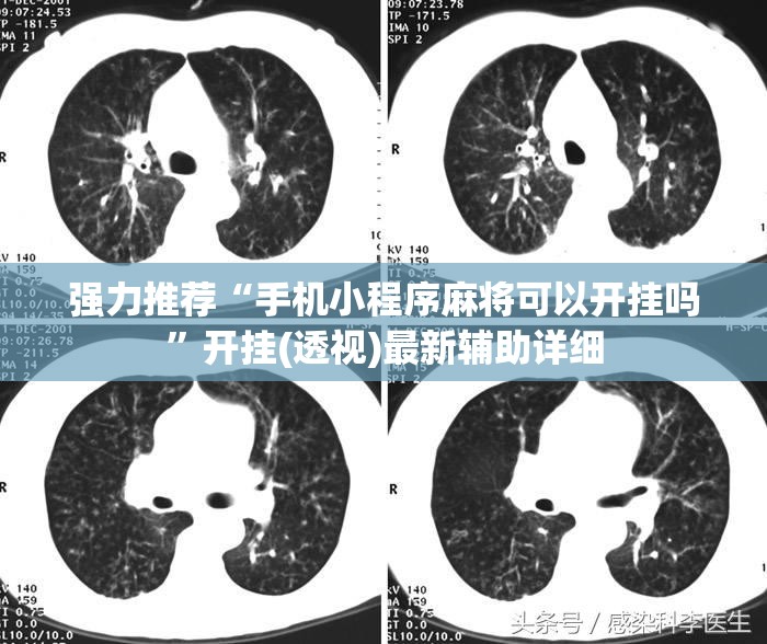 强力推荐“手机小程序麻将可以开挂吗”开挂(透视)最新辅助详细