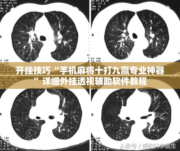 开挂技巧“手机麻将十打九赢专业神器”详细外挂透视辅助软件教程