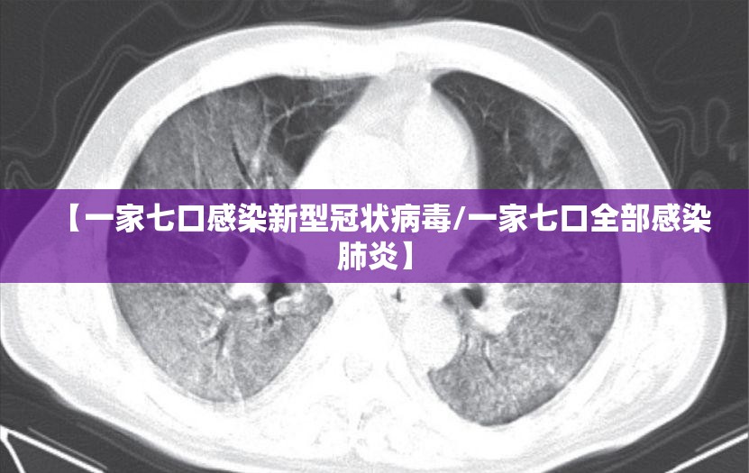 【一家七口感染新型冠状病毒/一家七口全部感染肺炎】 【一家七口感染新型冠状病毒/一家七口全部感染肺炎】