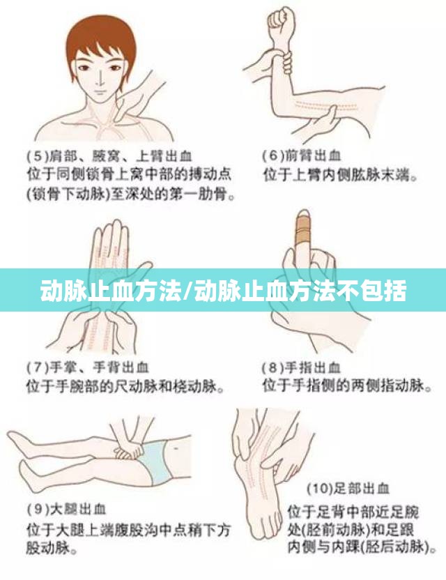 动脉止血方法/动脉止血方法不包括 动脉止血方法/动脉止血方法不包括