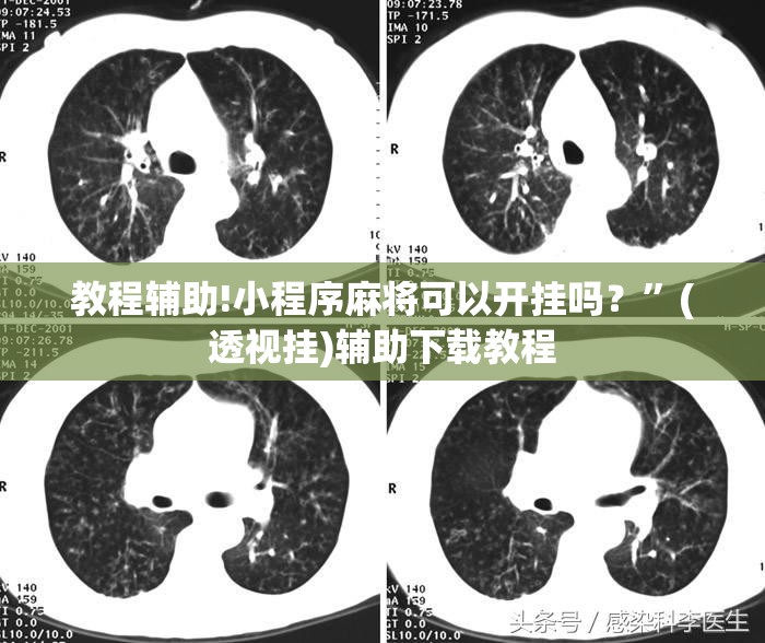 教程辅助!小程序麻将可以开挂吗？”(透视挂)辅助下载教程
