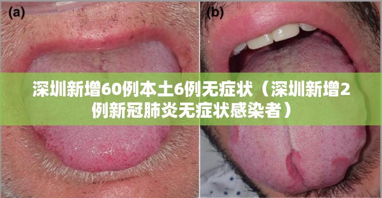 深圳新增60例本土6例无症状（深圳新增2例新冠肺炎无症状感染者）