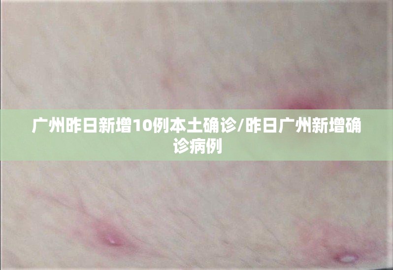 广州昨日新增10例本土确诊/昨日广州新增确诊病例