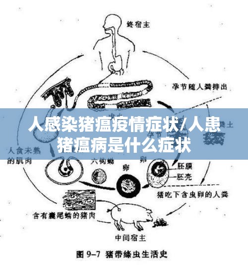 人感染猪瘟疫情症状/人患猪瘟病是什么症状 人感染猪瘟疫情症状/人患猪瘟病是什么症状
