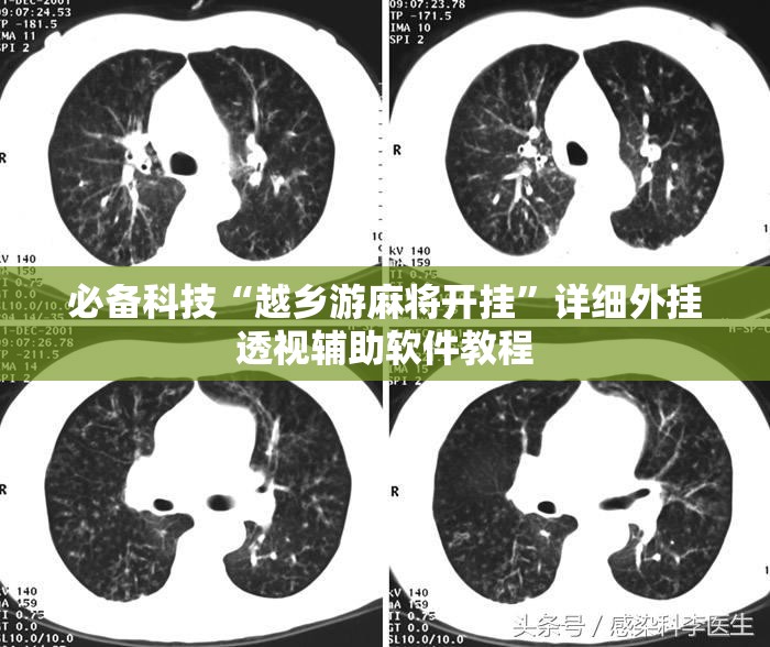 必备科技“越乡游麻将开挂”详细外挂透视辅助软件教程