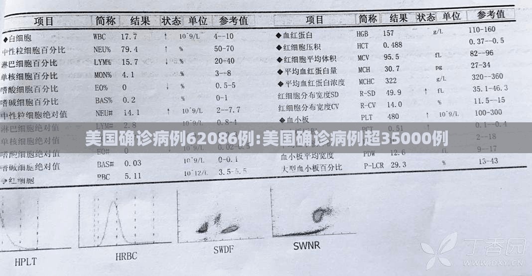 美国确诊病例62086例:美国确诊病例超35000例 美国确诊病例62086例:美国确诊病例超35000例