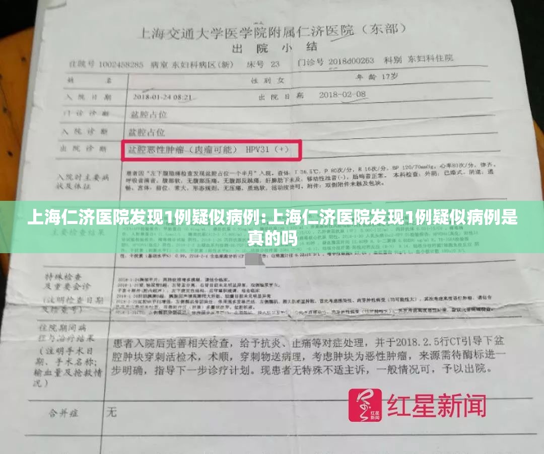 上海仁济医院发现1例疑似病例:上海仁济医院发现1例疑似病例是真的吗