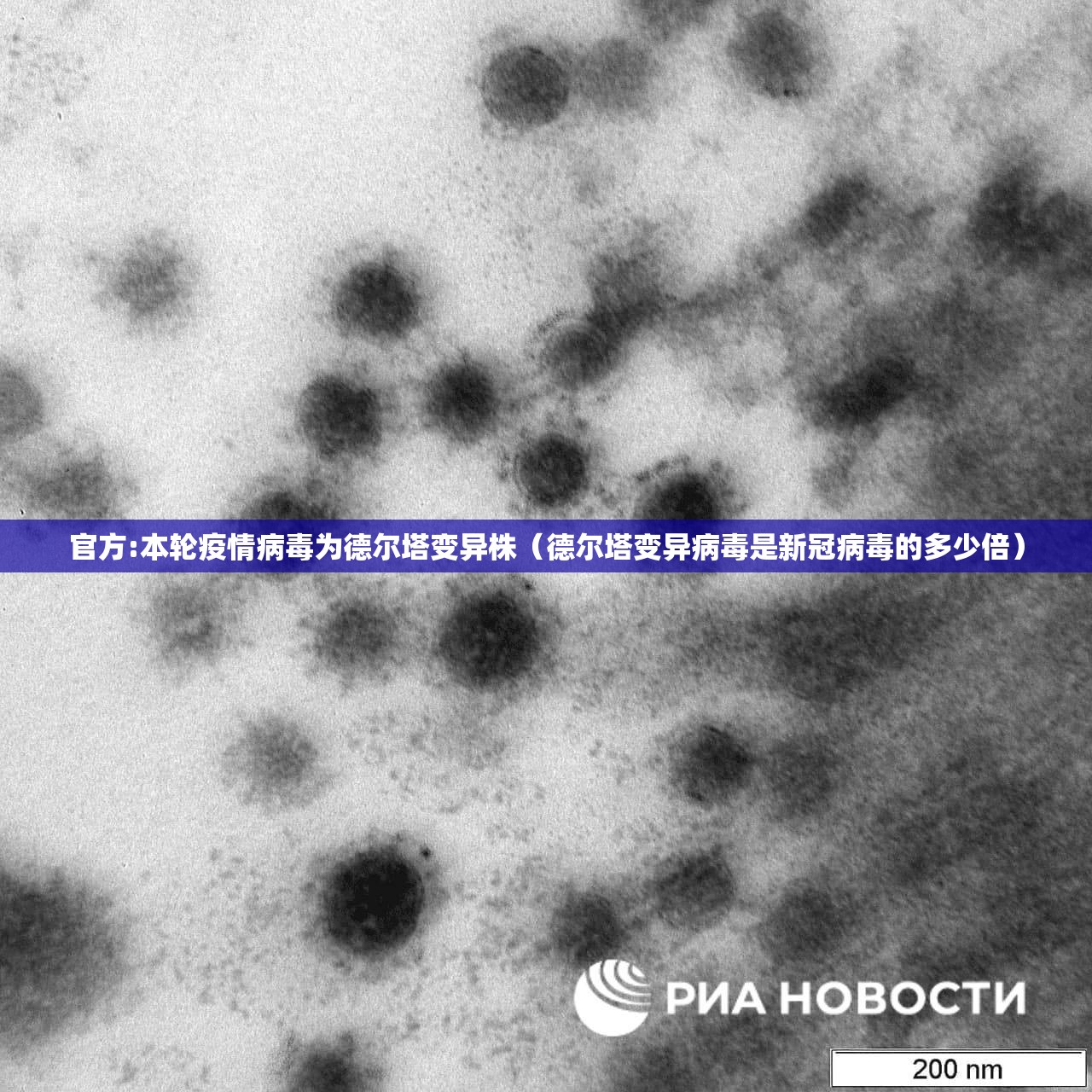 官方:本轮疫情病毒为德尔塔变异株（德尔塔变异病毒是新冠病毒的多少倍）
