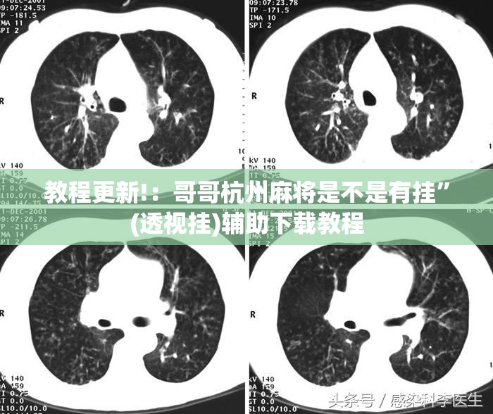 教程更新!：哥哥杭州麻将是不是有挂”(透视挂)辅助下载教程