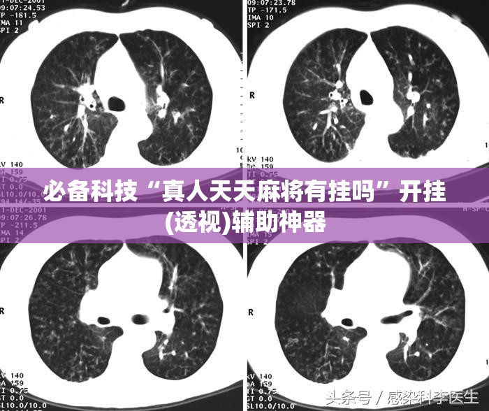 必备科技“真人天天麻将有挂吗”开挂(透视)辅助神器