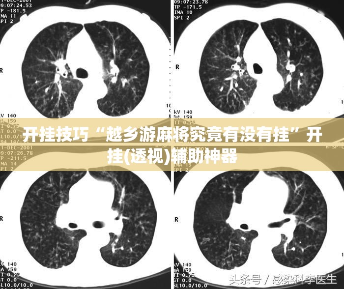 开挂技巧“越乡游麻将究竟有没有挂	”开挂(透视)辅助神器